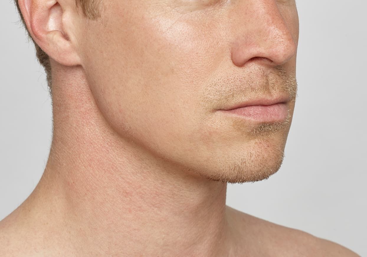 Jaw